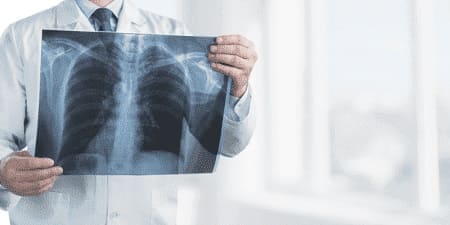 medico-especialista-en-enfermedades-respiratorias